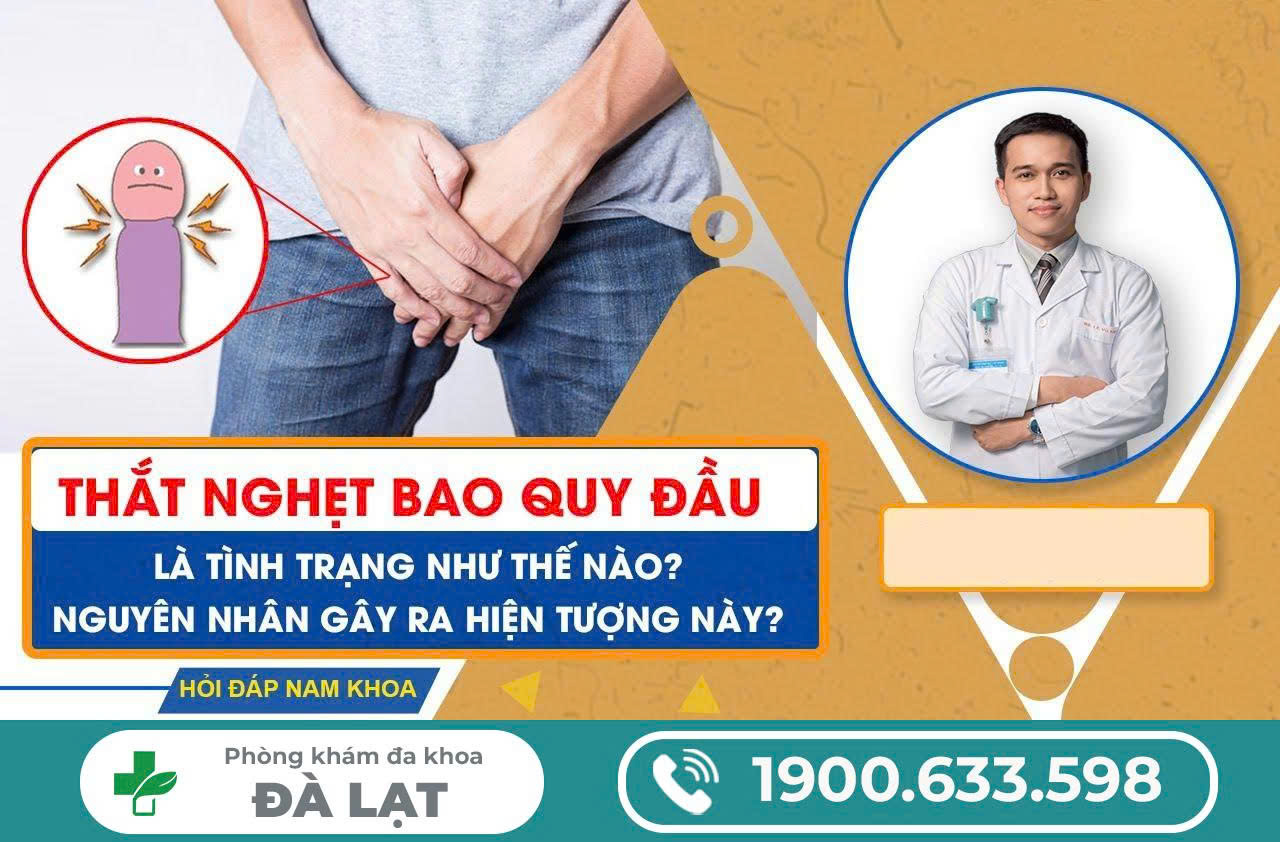 Hình ảnh minh họa